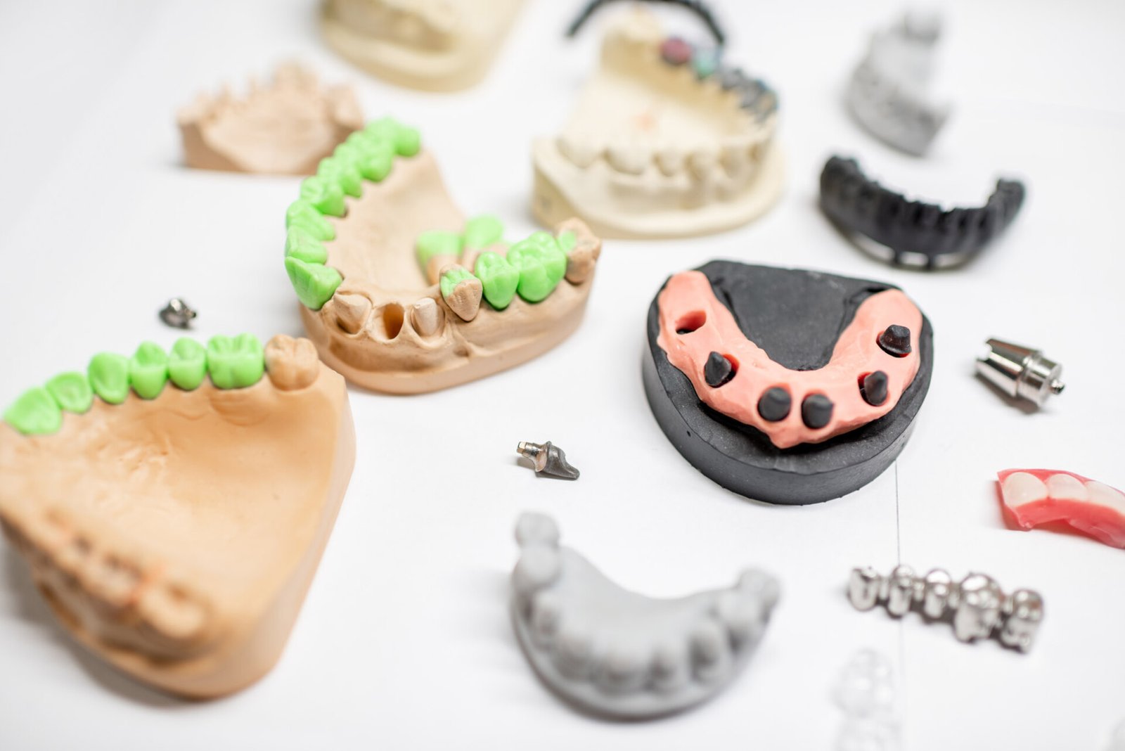 Capitol Dental Laboratory - Artificial jaw models with dental implants